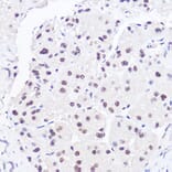 Immunohistochemistry - Anti-BRG1 Antibody (A13884) - Antibodies.com