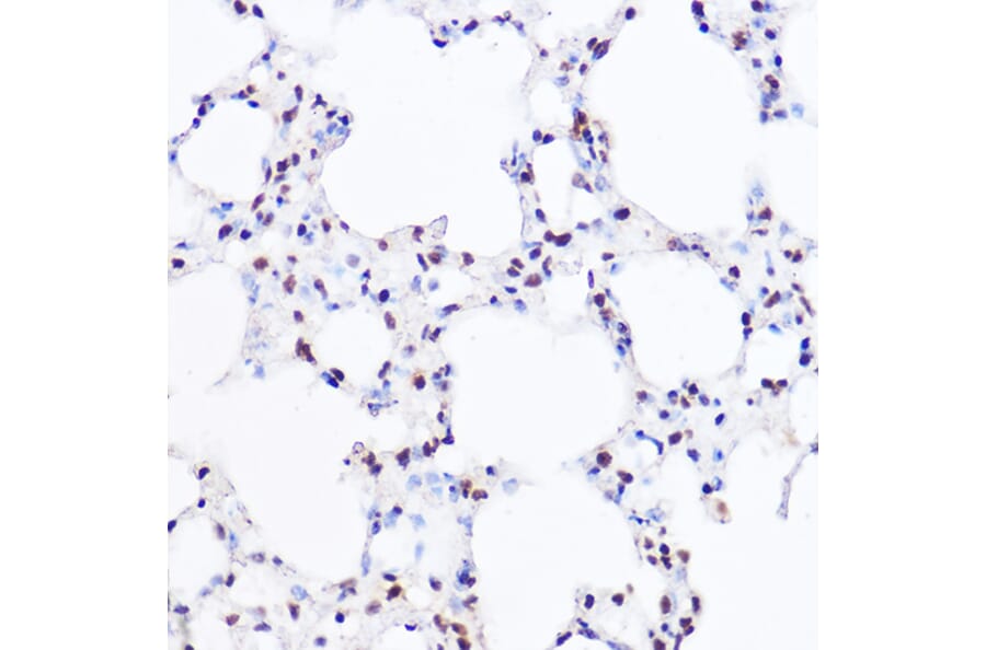 Immunohistochemistry - Anti-BRG1 Antibody (A13884) - Antibodies.com