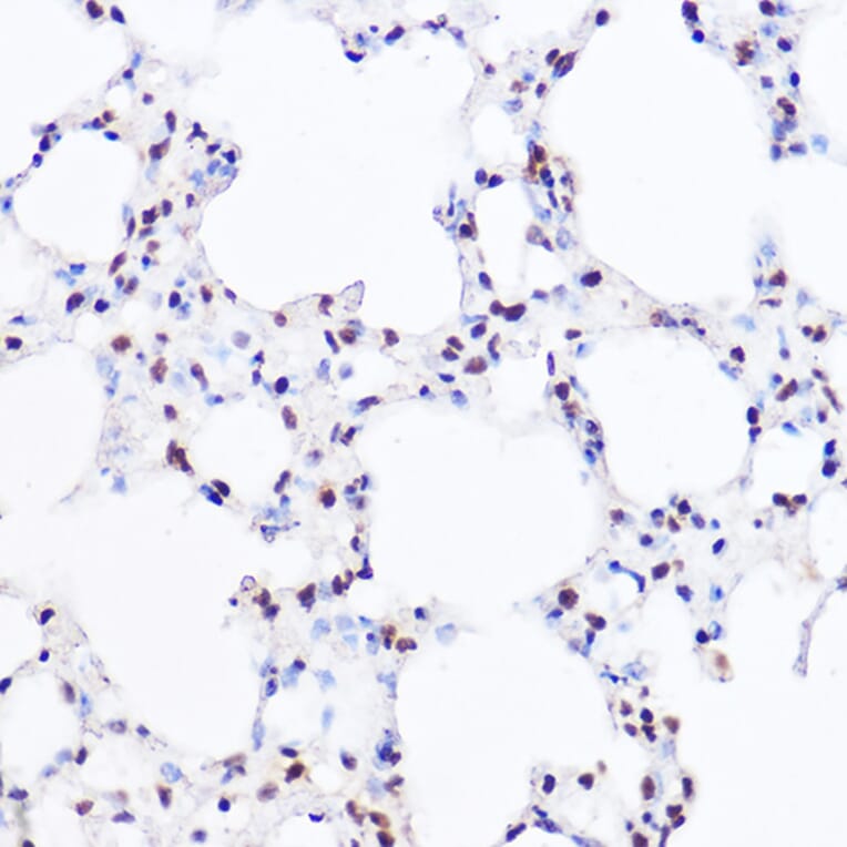 Immunohistochemistry - Anti-BRG1 Antibody (A13884) - Antibodies.com