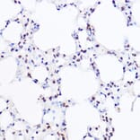 Immunohistochemistry - Anti-BRG1 Antibody (A13884) - Antibodies.com