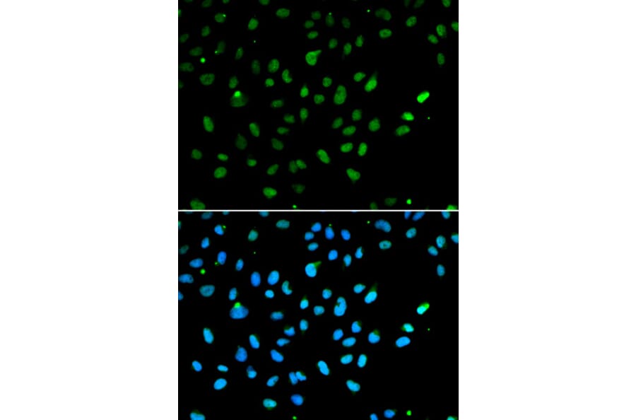 Immunofluorescence - Anti-BRG1 Antibody (A13884) - Antibodies.com