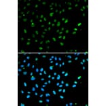 Immunofluorescence - Anti-BRG1 Antibody (A13884) - Antibodies.com