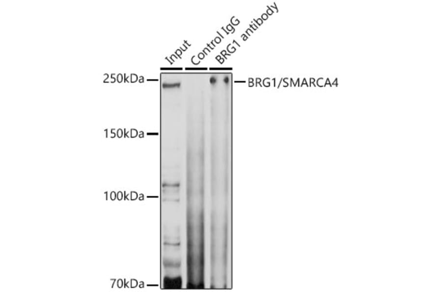 Western Blot - Anti-BRG1 Antibody (A13884) - Antibodies.com