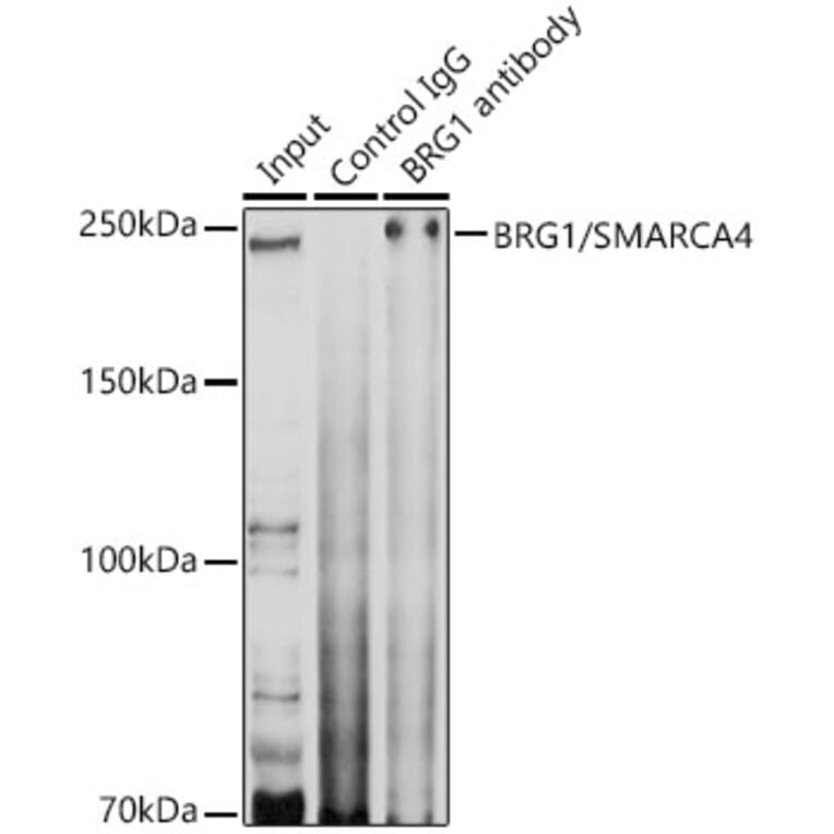 Western Blot - Anti-BRG1 Antibody (A13884) - Antibodies.com