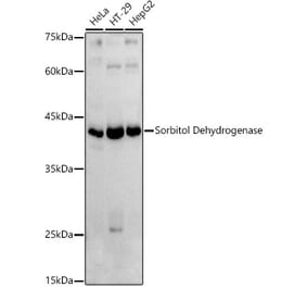 Western Blot - Anti-Sorbitol Dehydrogenase Antibody (A13885) - Antibodies.com
