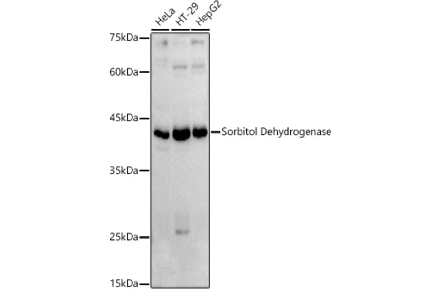 Western Blot - Anti-Sorbitol Dehydrogenase Antibody (A13885) - Antibodies.com