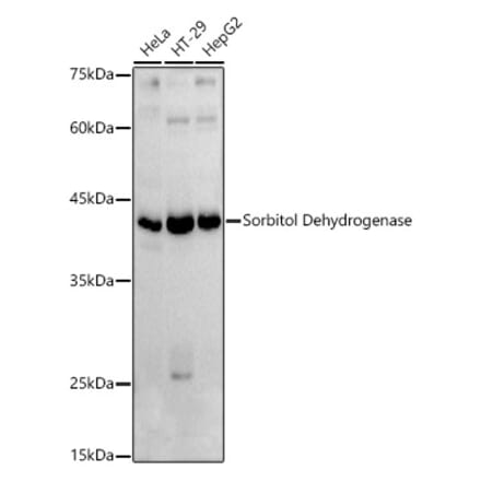Western Blot - Anti-Sorbitol Dehydrogenase Antibody (A13885) - Antibodies.com