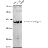 Western Blot - Anti-Sorbitol Dehydrogenase Antibody (A13885) - Antibodies.com