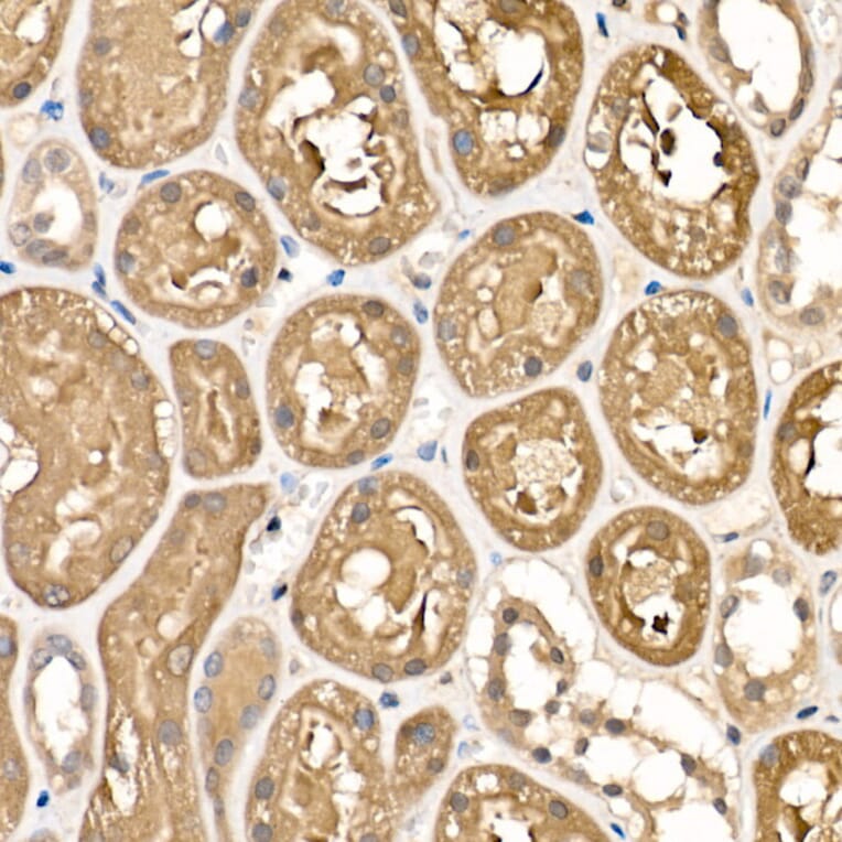 Immunohistochemistry - Anti-Sorbitol Dehydrogenase Antibody (A13885) - Antibodies.com