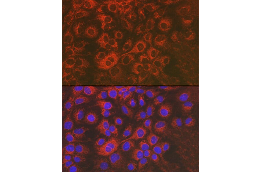 Immunofluorescence - Anti-Sorbitol Dehydrogenase Antibody (A13885) - Antibodies.com