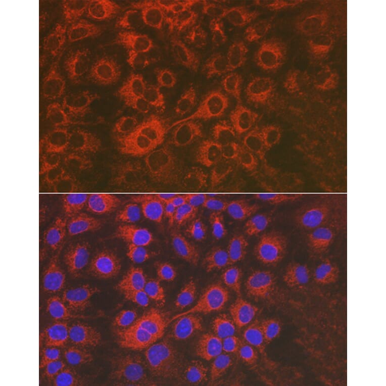 Immunofluorescence - Anti-Sorbitol Dehydrogenase Antibody (A13885) - Antibodies.com