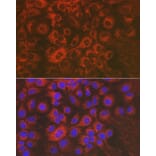 Immunofluorescence - Anti-Sorbitol Dehydrogenase Antibody (A13885) - Antibodies.com