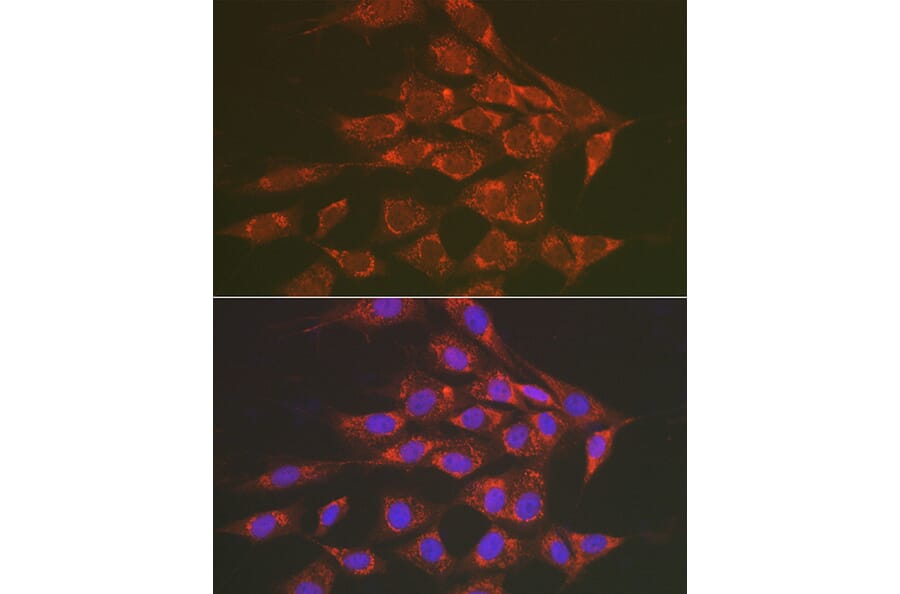 Immunofluorescence - Anti-Sorbitol Dehydrogenase Antibody (A13885) - Antibodies.com