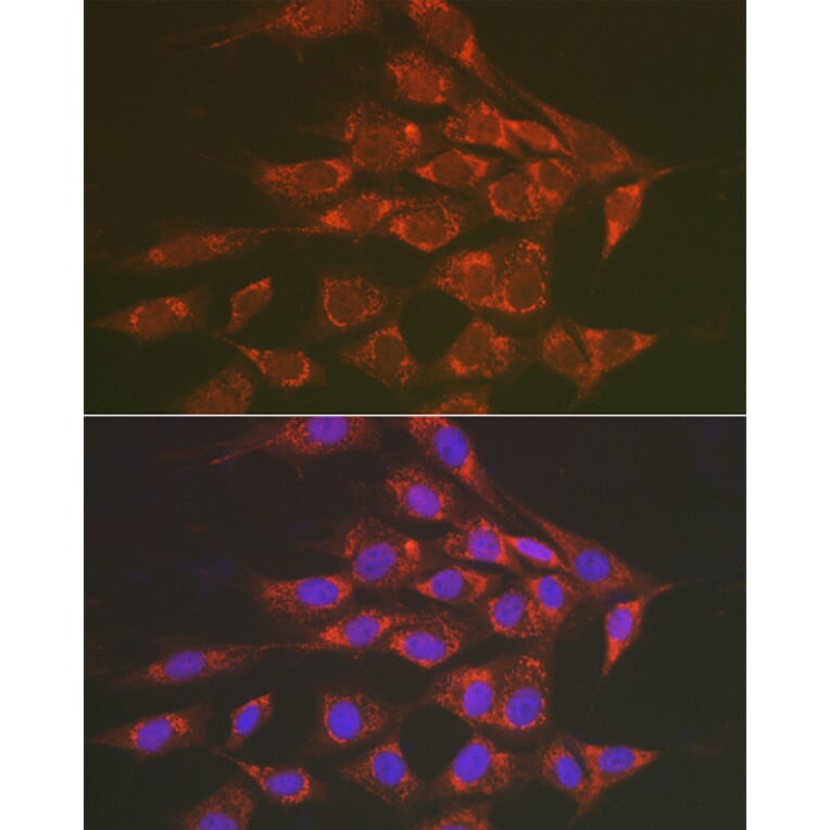 Immunofluorescence - Anti-Sorbitol Dehydrogenase Antibody (A13885) - Antibodies.com