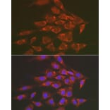 Immunofluorescence - Anti-Sorbitol Dehydrogenase Antibody (A13885) - Antibodies.com