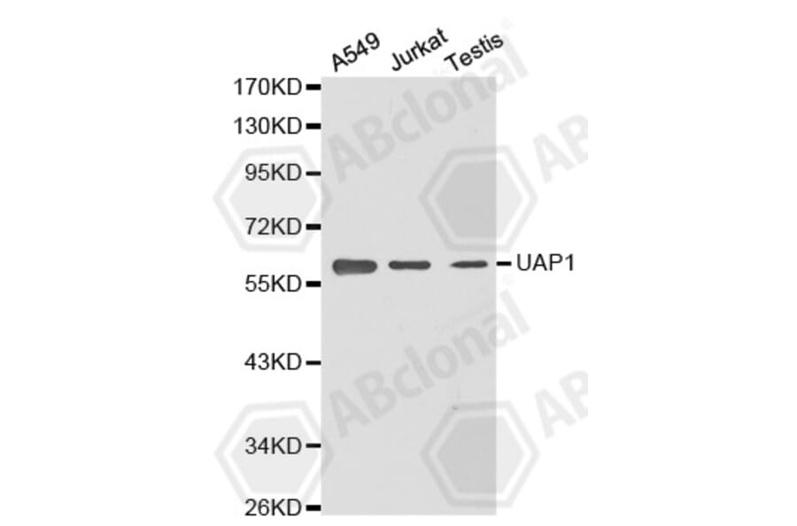 Western Blot - Anti-UAP1 Antibody (A2119) - Antibodies.com