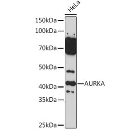 Western Blot - Anti-Aurora A Antibody (A13887) - Antibodies.com