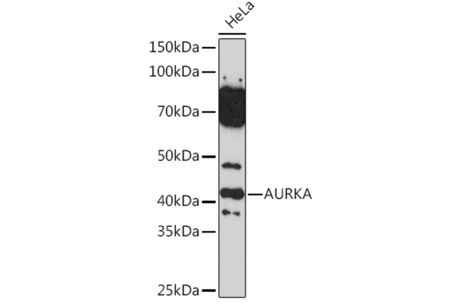 Western Blot - Anti-Aurora A Antibody (A13887) - Antibodies.com