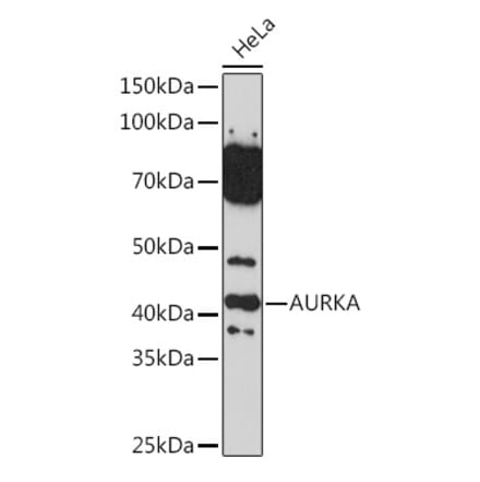 Western Blot - Anti-Aurora A Antibody (A13887) - Antibodies.com