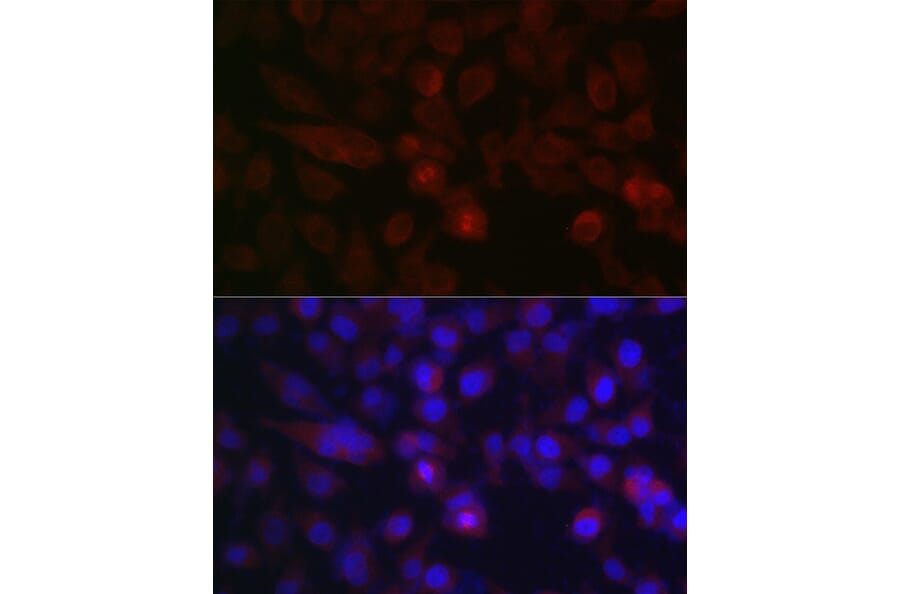 Immunofluorescence - Anti-Aurora A Antibody (A13887) - Antibodies.com