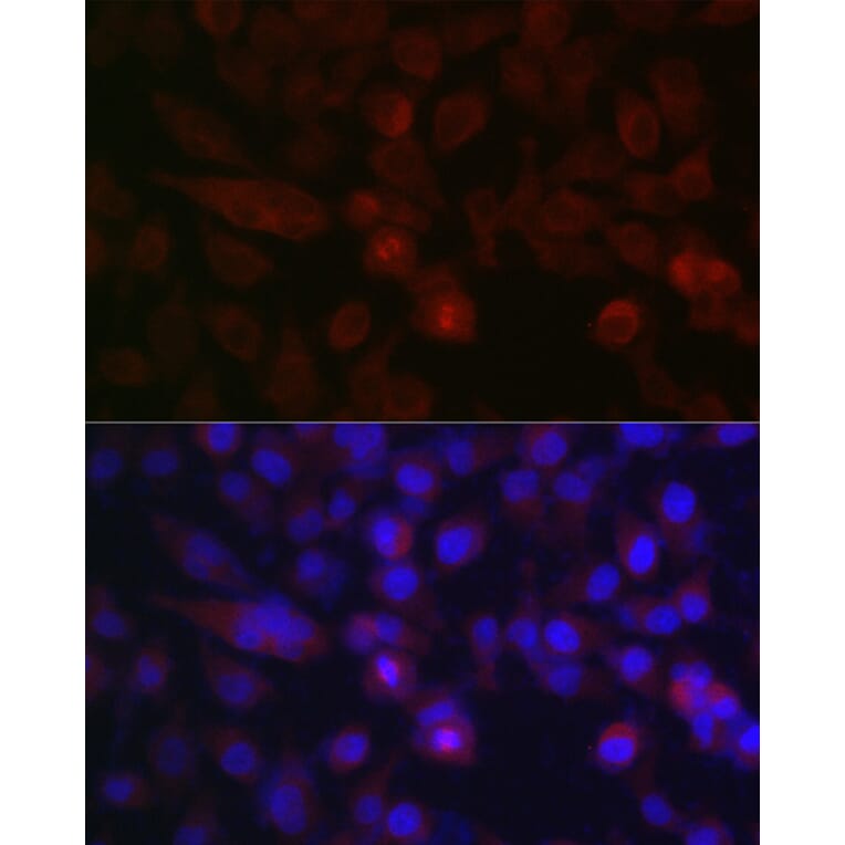 Immunofluorescence - Anti-Aurora A Antibody (A13887) - Antibodies.com