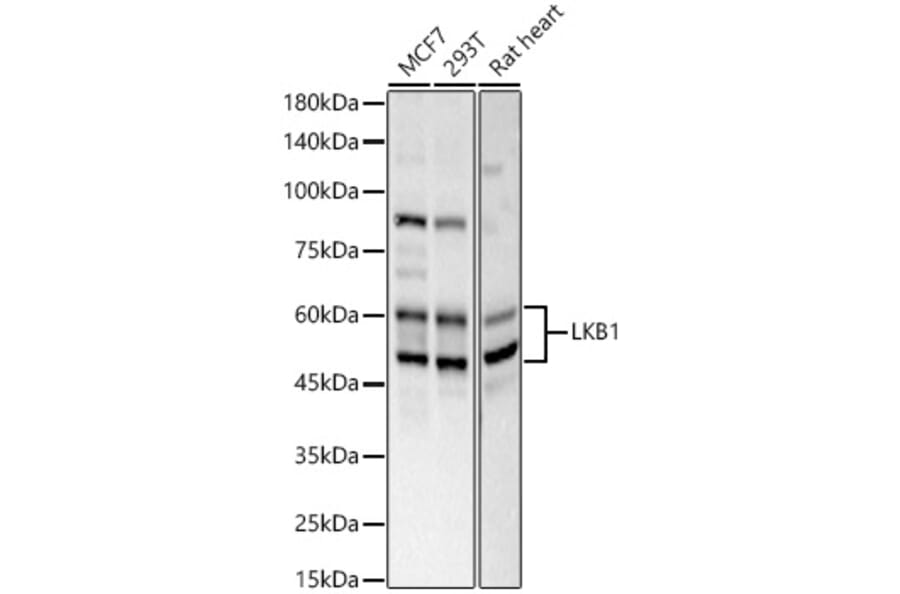 Western Blot - Anti-LKB1 Antibody (A13888) - Antibodies.com
