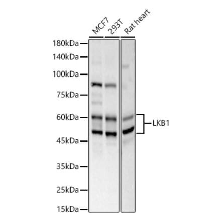Western Blot - Anti-LKB1 Antibody (A13888) - Antibodies.com
