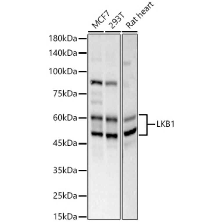 Western Blot - Anti-LKB1 Antibody (A13888) - Antibodies.com