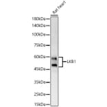 Western Blot - Anti-LKB1 Antibody (A13888) - Antibodies.com