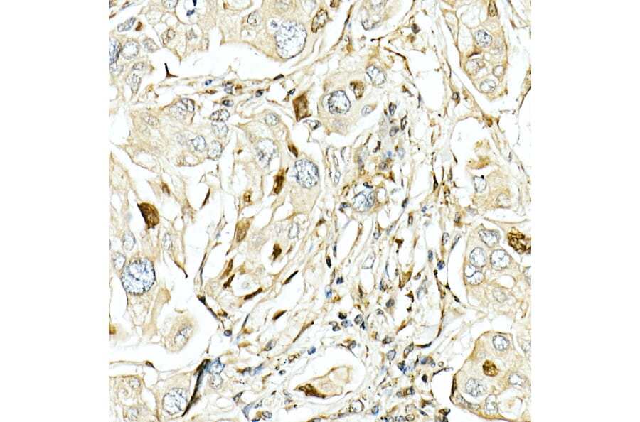 Immunohistochemistry - Anti-LKB1 Antibody (A13888) - Antibodies.com
