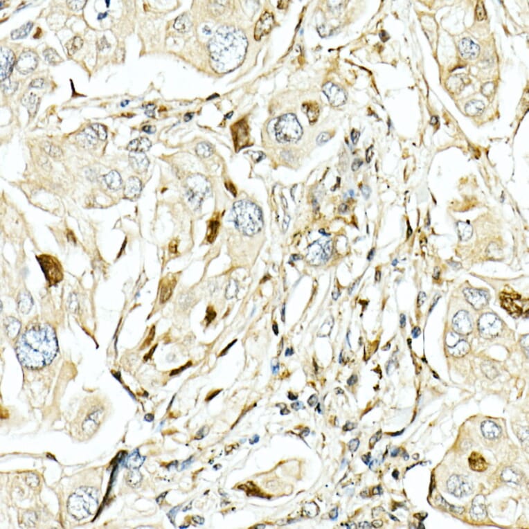 Immunohistochemistry - Anti-LKB1 Antibody (A13888) - Antibodies.com