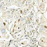 Immunohistochemistry - Anti-LKB1 Antibody (A13888) - Antibodies.com