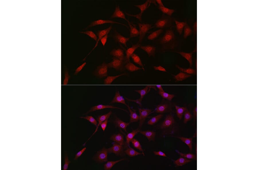 Immunofluorescence - Anti-LKB1 Antibody (A13888) - Antibodies.com