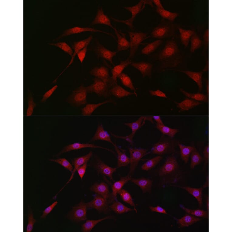 Immunofluorescence - Anti-LKB1 Antibody (A13888) - Antibodies.com