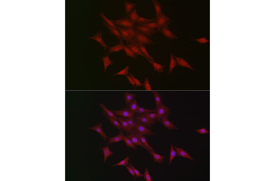 Immunofluorescence - Anti-LKB1 Antibody (A13888) - Antibodies.com