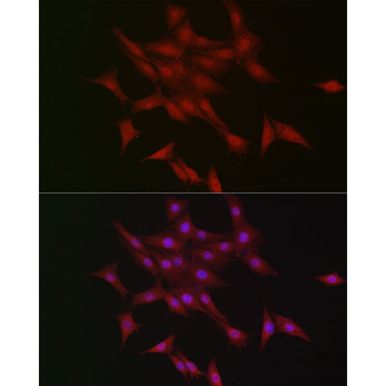 Immunofluorescence - Anti-LKB1 Antibody (A13888) - Antibodies.com