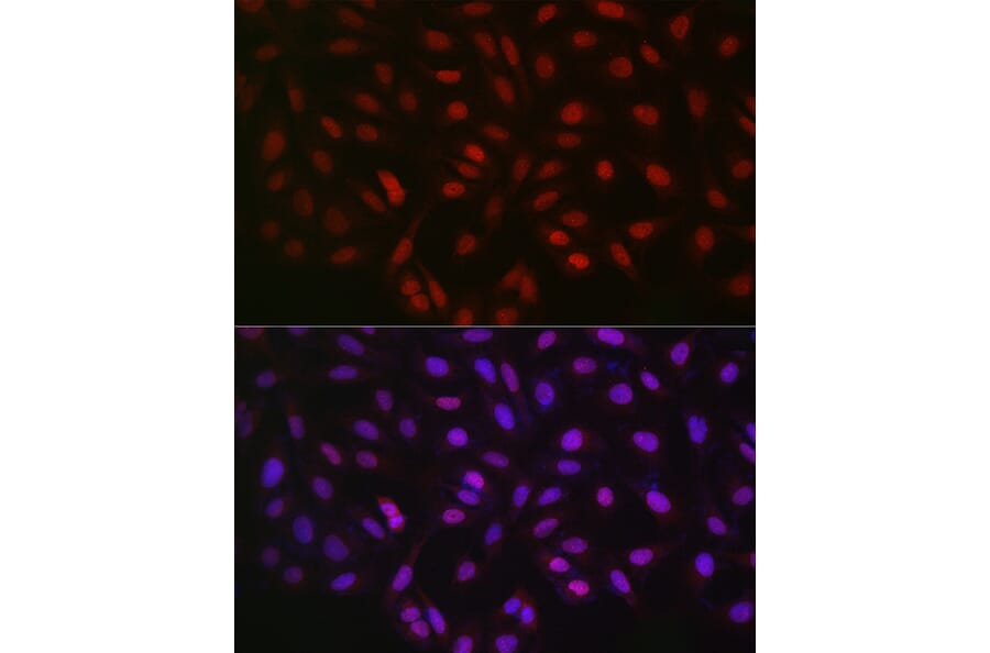 Immunofluorescence - Anti-LKB1 Antibody (A13888) - Antibodies.com