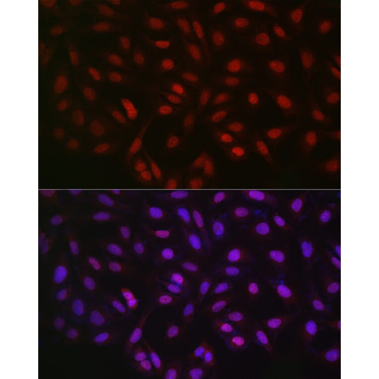 Immunofluorescence - Anti-LKB1 Antibody (A13888) - Antibodies.com