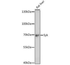 Western Blot - Anti-Syk Antibody (A13889) - Antibodies.com
