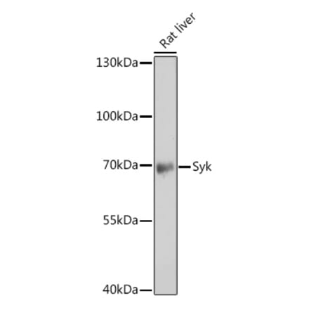 Western Blot - Anti-Syk Antibody (A13889) - Antibodies.com