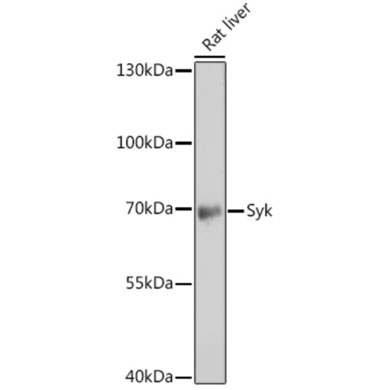 Western Blot - Anti-Syk Antibody (A13889) - Antibodies.com