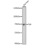 Western Blot - Anti-Syk Antibody (A13889) - Antibodies.com