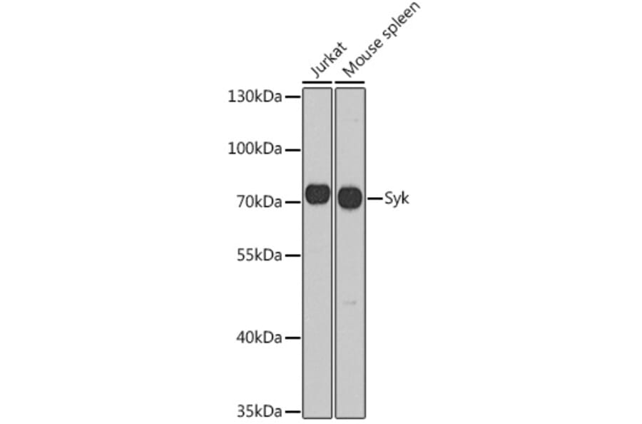 Western Blot - Anti-Syk Antibody (A13889) - Antibodies.com