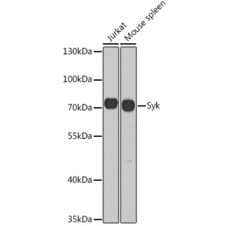 Western Blot - Anti-Syk Antibody (A13889) - Antibodies.com