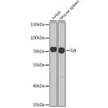 Western Blot - Anti-Syk Antibody (A13889) - Antibodies.com
