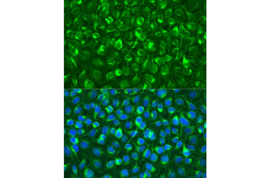Immunofluorescence - Anti-Syk Antibody (A13889) - Antibodies.com