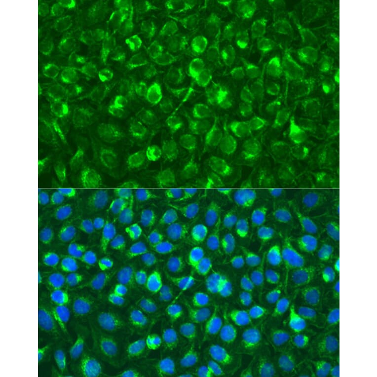 Immunofluorescence - Anti-Syk Antibody (A13889) - Antibodies.com