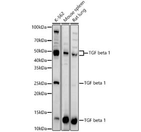 Western Blot - Anti-TGF beta 1 Antibody (A13890) - Antibodies.com
