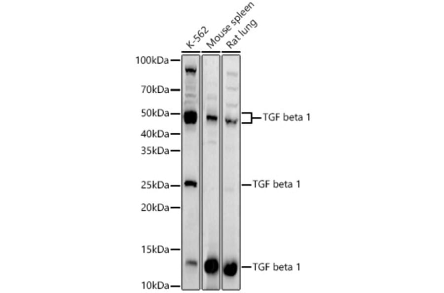 Western Blot - Anti-TGF beta 1 Antibody (A13890) - Antibodies.com