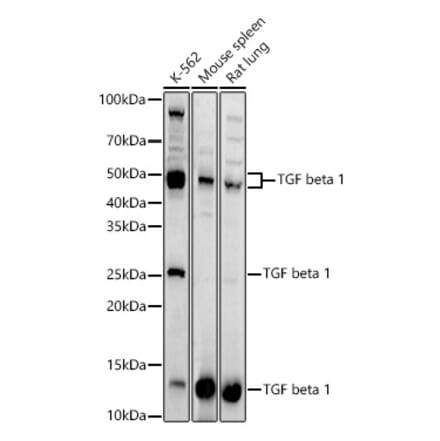 Western Blot - Anti-TGF beta 1 Antibody (A13890) - Antibodies.com